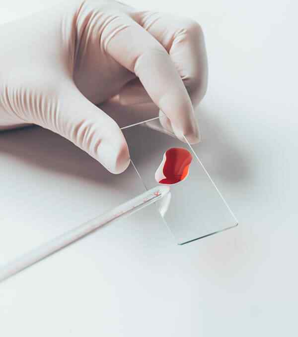 HEMATOLOGÍA 